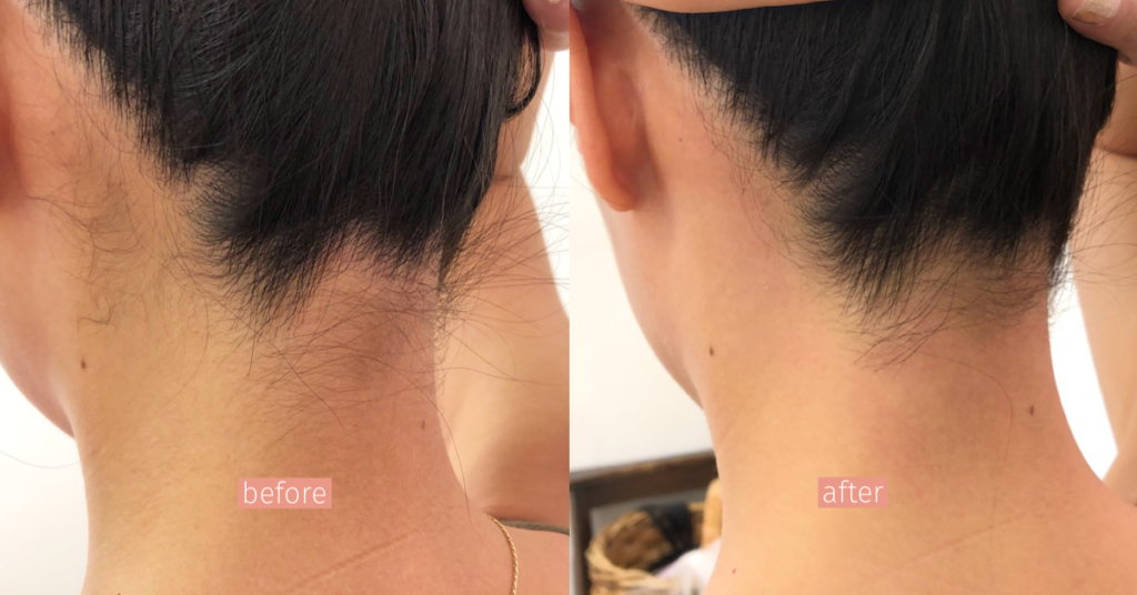 うなじシュガーリング モレーナ