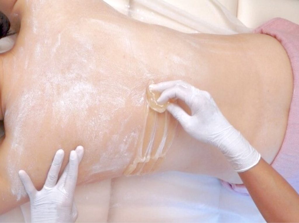 モレーナシュガーリング19012022